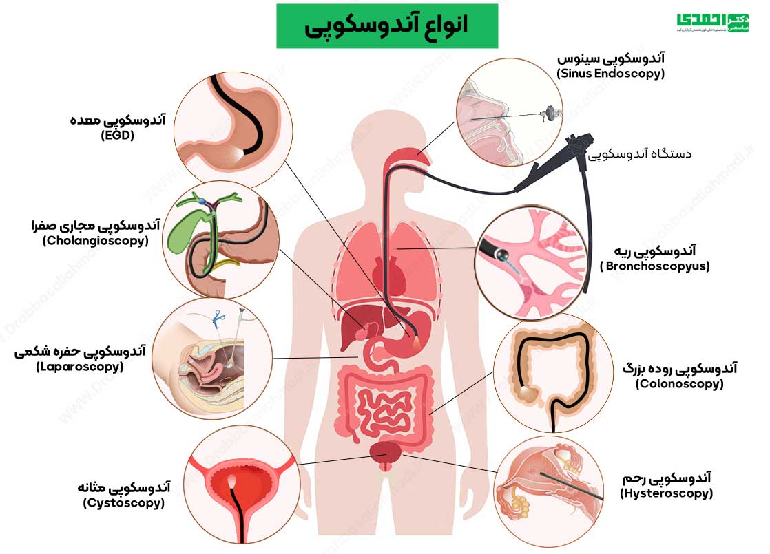 قبل و بعد از آندوسکوپی و کولونوسکوپی چی بخوریم؟